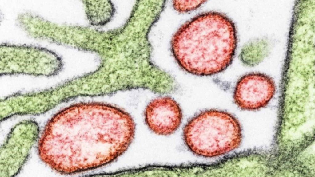 The-Nipah-virus-pictured-in-red-credit-US-NIH.jpg