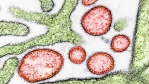 The-Nipah-virus-pictured-in-red-credit-US-NIH.jpg